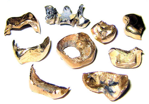Скупка стоматологического золота